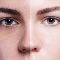 Понимание потребностей кожи – факторы, влияющие на кожу